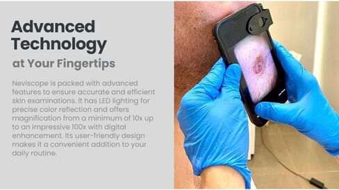 Neviscope Black Phone Dermatoscope Microscope with Polarized Lens/LED Light, 100x Camera Attachment with Universal Clip for Most iPhone/Android Phones Free App in Kuwait
