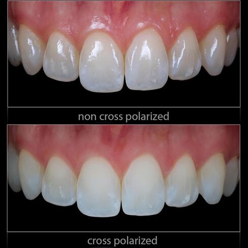 Cross-Polarization Sets for Flashes - Dental Photography Polarizer Set for Camera (YONGNUO YN-14EX) No Glare, No Reflections Camera Photography in Kuwait