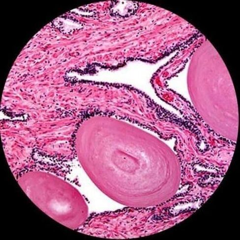 AmScope M620B Compound Monocular Microscope, WF10x and WF20x Eyepieces, 40x-2000x Magnification, Brightfield, LED Illumination, Abbe Condenser, Mechanical Stage, 110V | 40X-2000X Magnification Range Compound Biological Microscope Mechanical Stage Built-In in Kuwait