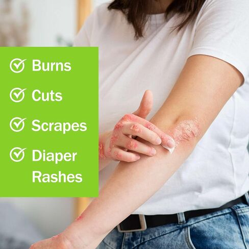 Skin Protectant Rash Cream - 4oz of Zinc Oxide Barrier Cream for Diaper Rashes, Chapped and Chafed Skin, and More - Made with Zinc, Vitamins A, D, E, and Aloe in Kuwait