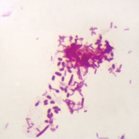 Pseudomonas aeruginosa, w.m. Microscope Slide in Kuwait