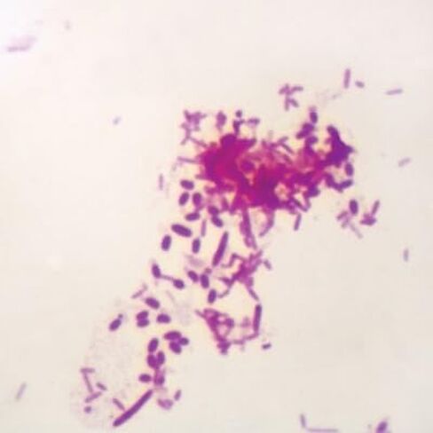 Pseudomonas aeruginosa, w.m. Microscope Slide in Kuwait