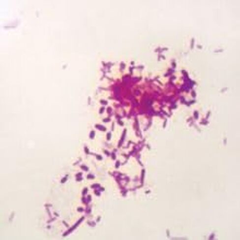 Pseudomonas aeruginosa, w.m. Microscope Slide in Kuwait