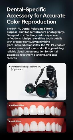 Godox MF-T76S MF-T76 S Macro Twin Flash for Sony Camera Flash Speedlight,76Ws 2.4G TTL 1/8000 HSS,LCD Display Adapter Rings,1.2s Recycle Time,550 Full Power Flash in Kuwait