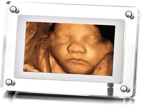 MBHB Digital Picture Frame, 7" Screen, Electronic Photo Frames for Ultrasound Replay, Re-Chargeable 4GB Memory, USB Charging, Vertical/Horizontal Display, Upload Photos/Videos Easily in Saudi Arabia