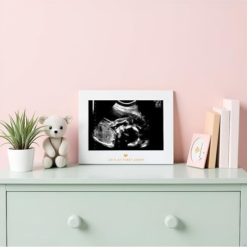 Pearhead Little Blossoms Love At First Sight Sonogram Picture Frame, Ultraound Pregnancy Keepsake, Gender-Neutral Nursery Décor For Baby Girl or Baby Boy, Polka Dot, 6.94x5.25x.75 Inch (Pack of 1) in Kuwait