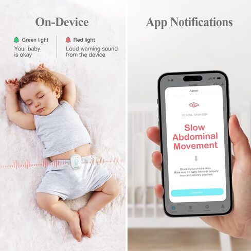 Sense-U Pro Baby Monitor – Breathing Movement, Rollover & Overheating Trackers for Better Sleep, Simple Clip-On Smart Sleep Monitor with Arousal Vibration, Audible Alerts & Sleep Analysis in Saudi Arabia