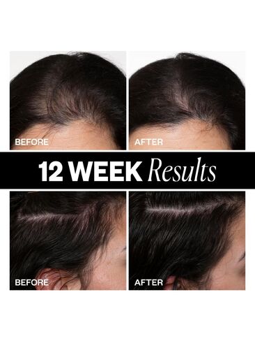 Old Navy IGK Sponsored High Density Scalp Treatment - Clear in Kuwait