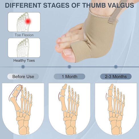 KTSAY 2PCS Bunion Corrector for Women & Men, Big Toe Straightener with Splint & Pads, Comfortable & Breathable for Day/Night Support, Hallux Valgus Pain Relief Non-Slip Socks (1, Black) in Saudi Arabia