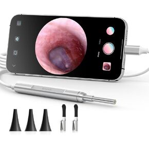 أداة إزالة شمع الأذن من Anykit، نطاق الأذن فائق الوضوح مع أضواء LED لتنظيف الأذن، منظار الأذن للكاميرا لتنظيف الأذن مع ملعقة الأذن ومنظار للهاتف والكمبيوتر اللوحي in Kuwait
