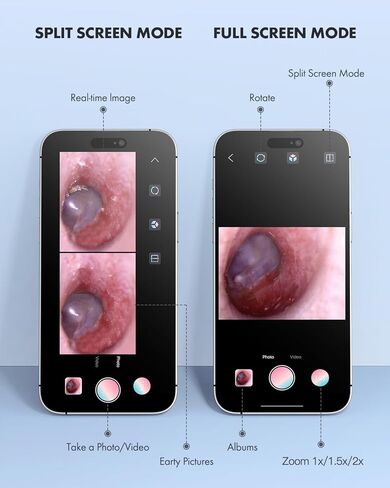 أداة إزالة شمع الأذن من Anykit، نطاق الأذن فائق الوضوح مع أضواء LED لتنظيف الأذن، منظار الأذن للكاميرا لتنظيف الأذن مع ملعقة الأذن ومنظار للهاتف والكمبيوتر اللوحي in Kuwait