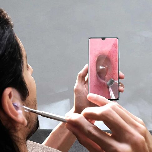 أداة إزالة شمع الأذن من Anykit، نطاق الأذن فائق الوضوح مع أضواء LED لتنظيف الأذن، منظار الأذن للكاميرا لتنظيف الأذن مع ملعقة الأذن ومنظار للهاتف والكمبيوتر اللوحي in Kuwait