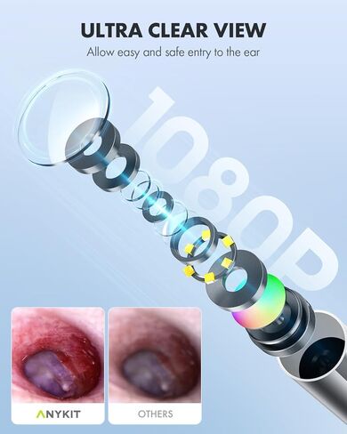 أداة إزالة شمع الأذن من Anykit، نطاق الأذن فائق الوضوح مع أضواء LED لتنظيف الأذن، منظار الأذن للكاميرا لتنظيف الأذن مع ملعقة الأذن ومنظار للهاتف والكمبيوتر اللوحي in Kuwait