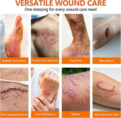 10 Pack Honey Wound Dressing,4'' x 4''Manuka Honey Gauze Dressing,Non-Stick in Kuwait