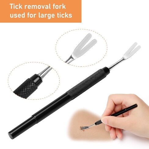 COITEK 3 in 1 Tick Remover Kit, Black Tick Remover Tweezers Stainless Steel Tick Remover Tools Set for Pet Dog, Cat, Human with Storage Box (Black) in Saudi Arabia