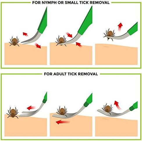 TickCheck Premium Tick Remover Kit - Stainless Steel Tick Remover + Tweezers, Leather Case, and Free Pocket Tick Identification Card (1 Set) in Kuwait