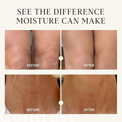 Bikini Area Exfoliator, Exfoliating Scrub for Bikini Area, Ingrown Hair Treatment for Bikini Area, Razor Bump Treatment for Bikini Area, Sugar Scrub for Bikini Area, Shaving Exfoliator Scrub for Women in Saudi Arabia