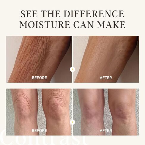 Bikini Area Exfoliator, Exfoliating Scrub for Bikini Area, Ingrown Hair Treatment for Bikini Area, Razor Bump Treatment for Bikini Area, Sugar Scrub for Bikini Area, Shaving Exfoliator Scrub for Women in Saudi Arabia