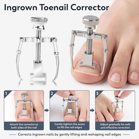 JTIEO 9PCS Toenail Clippers Tool, Ingrown Toenail Treatment Stainless Steel Removal Kit Professional Tool Set for Ingrown & Thick Nail in Saudi Arabia