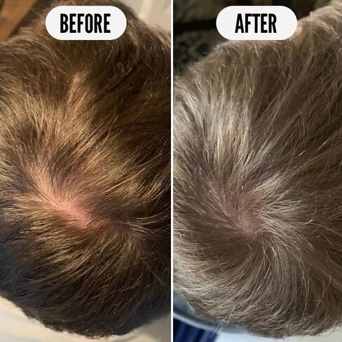 Noughty 97% Natural Get Set Grow Tonic, Leave in Treatment for Thicker and Fuller Looking Hair with Pea Complex and Hyaluronic Acid, Sulphate Free Vegan Haircare 75ml in Kuwait