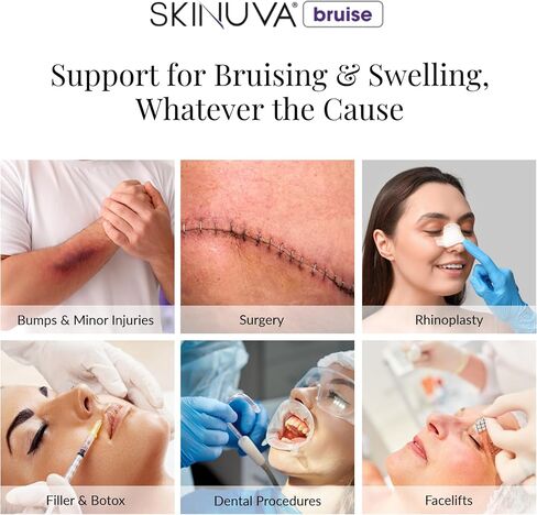 Skinuva® Bruise, Arnica + Bromelain + Zinc Supplement for Bruising and Swelling, Homeopathic Bruise Remedy - 14 Capsules (7 Day Treatment) in Kuwait