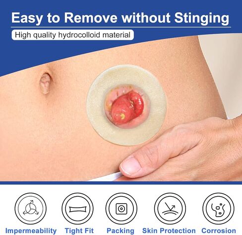 Ostomy Barrier Rings-Outer Diameter: 2" (50mm) 3.5mm Thickness,Compatible with All Bag Types and Brands (2" (Pack of 10)) in Kuwait