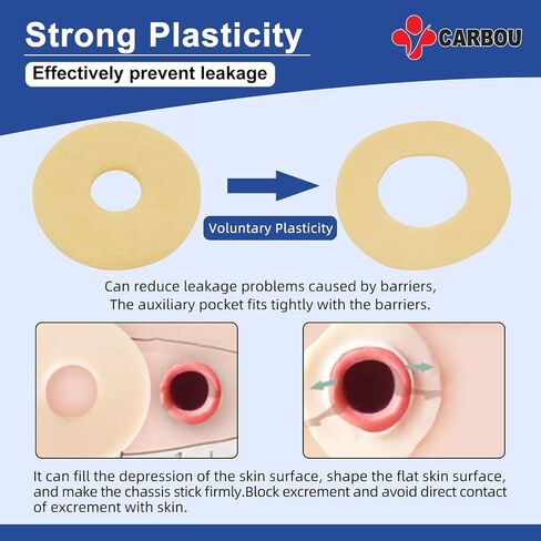 Ostomy Barrier Rings-Outer Diameter: 2" (50mm) 3.5mm Thickness,Compatible with All Bag Types and Brands (2" (Pack of 10)) in Kuwait