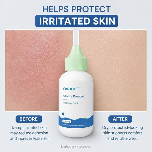 Stoma Powder，Protects Skin Keep Dry Ostomy Powder (2 Bottles) in Kuwait
