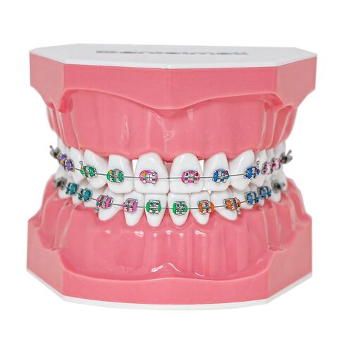 Dentalmall Typodonts Orthodontics Demonstration Model with Metal Wires and Bracket Teaching, Learning, Interpretation Model for Adults and Children (Metal Bracket) in Kuwait