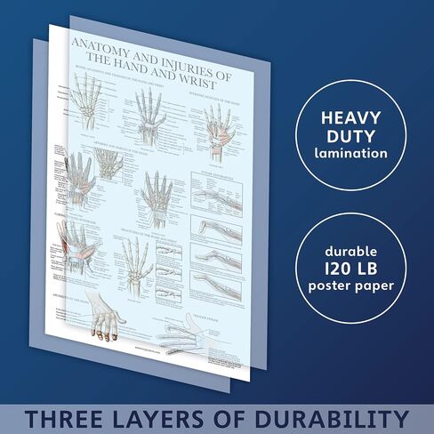 Laminated Anatomy and Injuries of the Hand and Wrist Poster - Hand and Wrist Joint Anatomical Chart - 18" x 24" in Kuwait