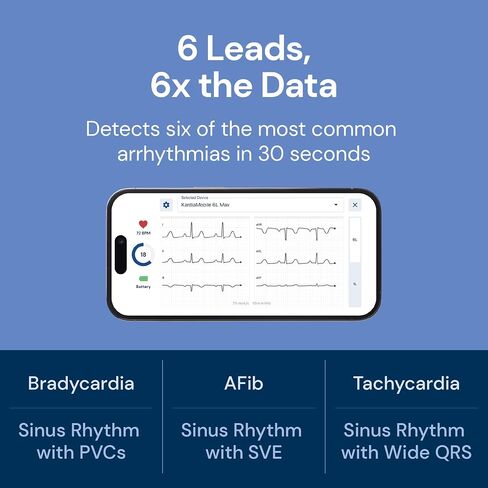 KardiaMobile Personal EKG Heart Rate Monitor – 6 Leads - Record EKGs at Home - Detect Irregular Heartbeats and Irregular Arrhythmias - Includes 1 Year Access - Works with Most Smartphones – AliveCor in Kuwait