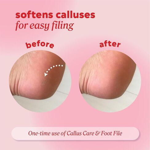 Onyx Professional Callus Remover for Feet - 3.5 oz, Unscented, Powerful Formulation - Extra Strength Gel, Removes Unwanted Calluses in 3-5 Minutes, Hydrating and Softening Heel Callus Remover, 3 Pack in Kuwait