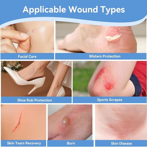 3-in-1 Hydrocolloid Bandage Roll (2" x 16.4 ft) - Sterilized, Waterproof Wound Dressing for DIY Sizing, Latex-Free and Hypoallergenic, Great for Blisters, Cuts & Pimples (2" x 16.4 ft) in Kuwait