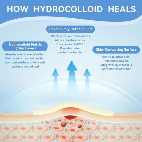3-in-1 Hydrocolloid Bandage Roll (2" x 16.4 ft) - Sterilized, Waterproof Wound Dressing for DIY Sizing, Latex-Free and Hypoallergenic, Great for Blisters, Cuts & Pimples (2" x 16.4 ft) in Kuwait