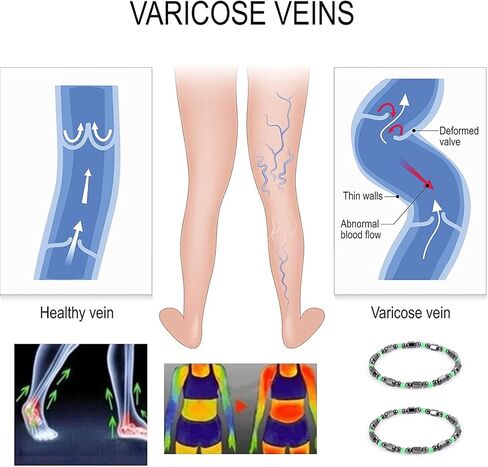 2 قطعة خلخال سبج أسود مضاد للتورم ، خلخال سبج أسود تورم ، سوار مطرز سبج للرجال/النساء هدايا in Kuwait