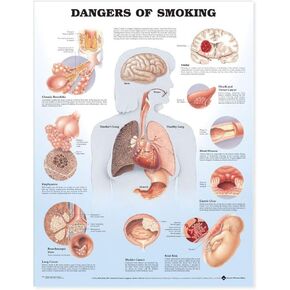 Dangers of Smoking Anatomical Chart