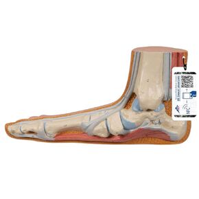 3B Scientific M31 Flat Foot (Pes Panus) - 3B Smart Anatomy