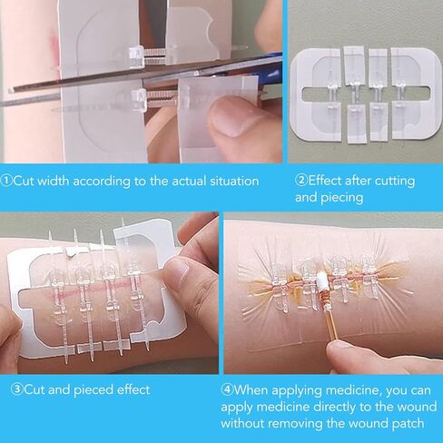 Zip Stitch, Wound Closure Strips, Emergency Protection Sutures Wounds, Cuttable Hygienic Zip Stitch Wound Bandages Zipper Band Aid Skin Adhesives Emergency Protection Zip in Kuwait
