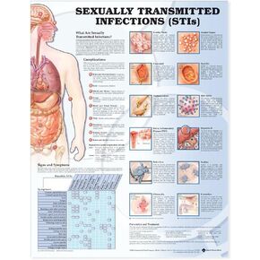 الرسم البياني التشريحي للأمراض المنقولة جنسيًا in Kuwait
