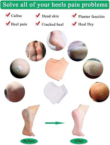 Gu Cheng Silicone Heel Protector, Moisturizing, Unisex, Shoe Insert, 2 Pairs in Saudi Arabia