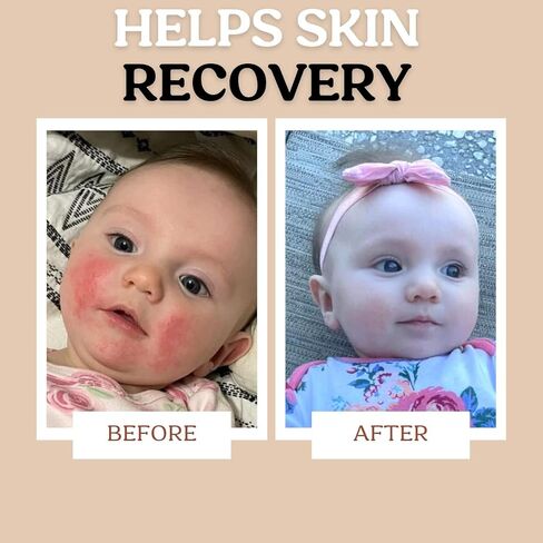 Baby Body & Face Biome Barrier Cream Lotion Ointment | Hydrating, Soothing, Clean Ingredients, All Over Protection | Safe For All Skin Babies, Toddlers & Kids (Barrier Cream) in Saudi Arabia