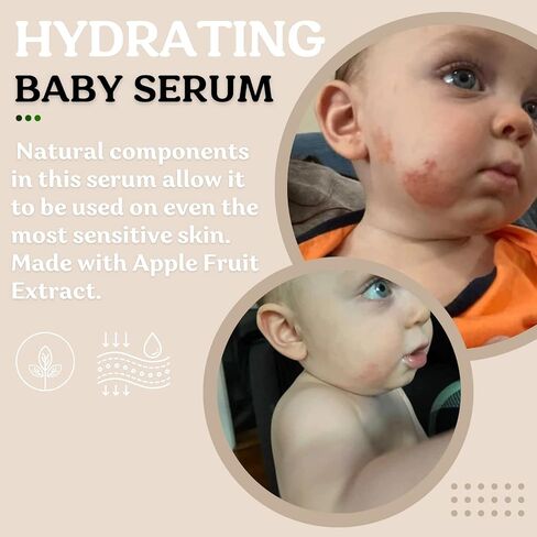 Baby Body & Face Biome Barrier Cream Lotion Ointment | Hydrating, Soothing, Clean Ingredients, All Over Protection | Safe For All Skin Babies, Toddlers & Kids (Barrier Cream) in Saudi Arabia