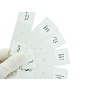 Prepared Protozoa Microscope Slides for Biology Science Education, Pack of 5pcs Specimens by DIY-SCIENCE