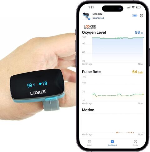 LOOKEE Ox-Minder Ring مقياس التأكسج بالنبض المستمر | شاشة أكسجين بلوتوث وقابلة للارتداء مع تذكير بالاهتزاز لانخفاض الأكسجين | جهاز تتبع نسبة تشبع الأكسجين في الدم SpO2 القابل لإعادة الشحن - تطبيق مجاني مع تقارير in Kuwait