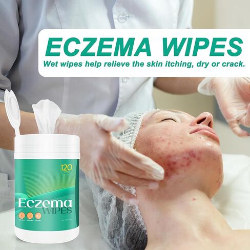 مناديل الأكزيما، مناديل علاج الأكزيما مع دقيق الشوفان، تخفيف الأكزيما سريع المفعول طبيعي بالكامل، يهدئ ويبرد على الفور الحكة والتشقق والتجفيف، مناديل عضوية واقية للبشرة in Kuwait