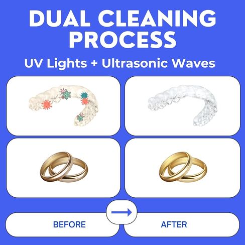 Ultrasonic Cleaner, UV Ultrasonic Cleaner for Aligner, Ultrasonic Bath for Retainer, Whitening Trays, Mouth Guard, Ultrasonic Cleaning Machine, Ultrasonic UV Bath in Saudi Arabia