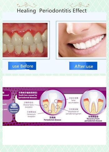 Toothpaste Healing Periodontitis, The ONLY Periodontal Toothpaste for Periodontal Disease Treatment Remove Plaque Tartar, Remineralize Avoid Loose and Falling Off Teeth (3.52 Oz * 2 Packs) in Saudi Arabia