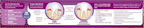 Toothpaste Healing Periodontitis, The ONLY Periodontal Toothpaste for Periodontal Disease Treatment Remove Plaque Tartar, Remineralize Avoid Loose and Falling Off Teeth (3.52 Oz * 2 Packs) in Saudi Arabia