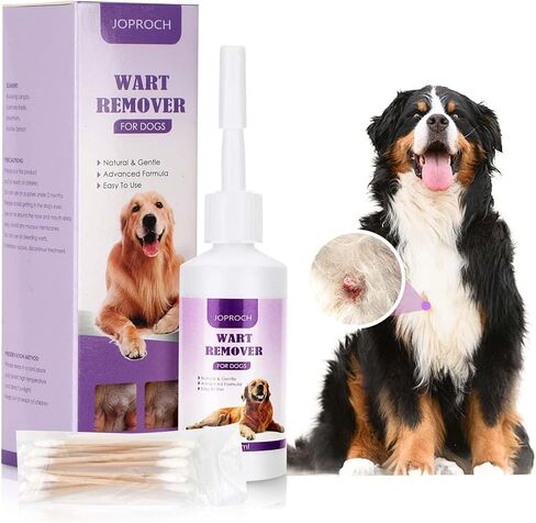 مزيل ثآليل الكلاب، علاج إزالة ثآليل الكلاب in Kuwait