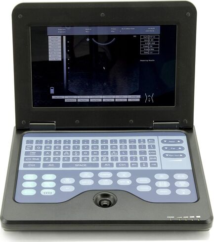 Portable Ultrasound Scanner Veterinary Pregnancy with 3.5 MHz Micro convex Probe for Cat/dog Small Animals in Saudi Arabia